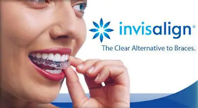 The Best Guide to Invisalign Doctor Site Login in 2023